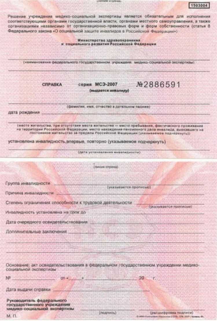 Как организовать рабочее место для сотрудника с инвалидностью 3 группы