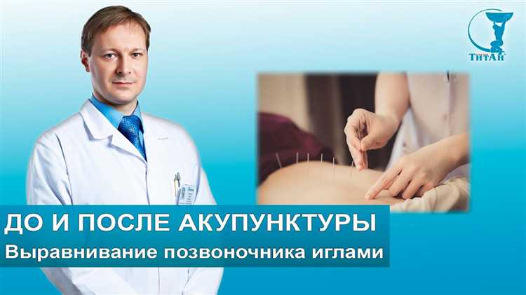 Специализация невролога: диагностика и лечение нервных заболеваний